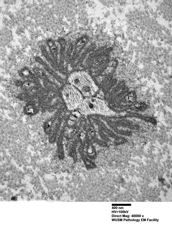 4G2 (Case 19)_019 - Copy