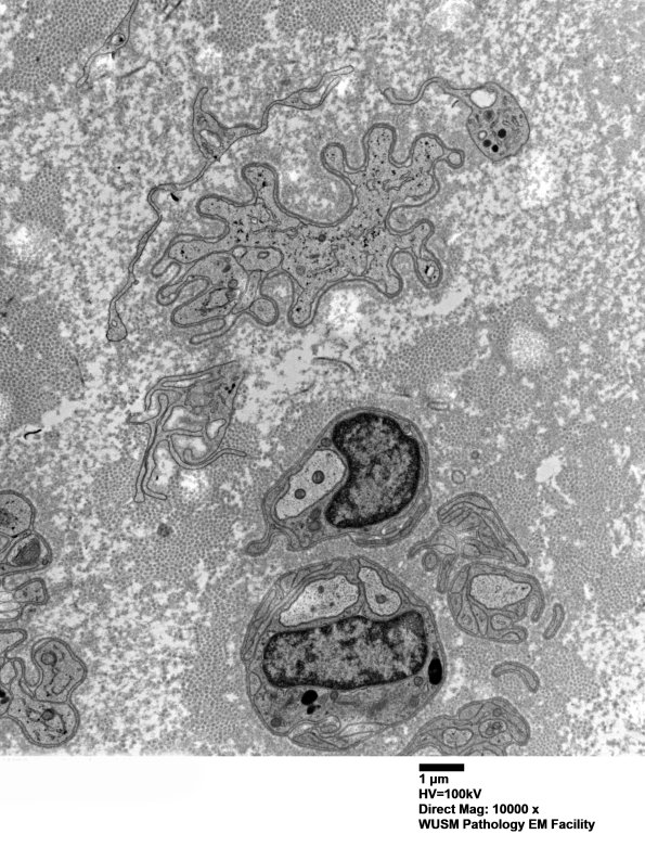 4H (Case 20) EM 034 - Copy