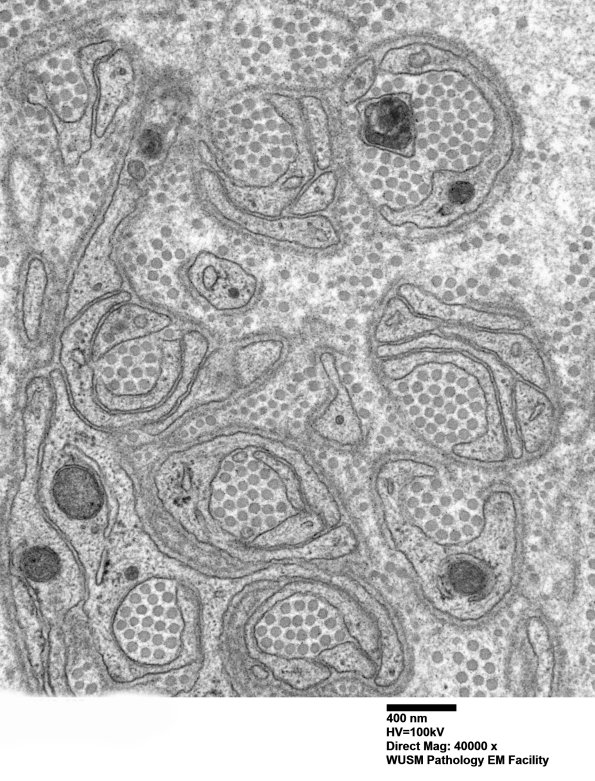 5C2 (Case 24) EM 025 - Copy