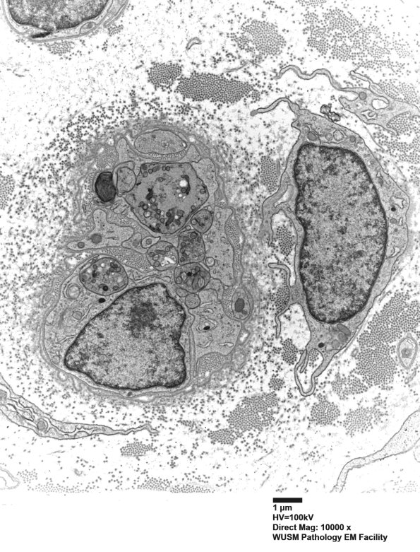 2E W20-543B Crocker J (Case 6) nerve_018 - Copy