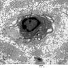 3E Macrophage, within basement membrane (Case 9) EM 019 - Copy