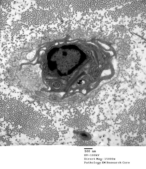 3E Macrophage, within basement membrane (Case 9) EM 019 - Copy