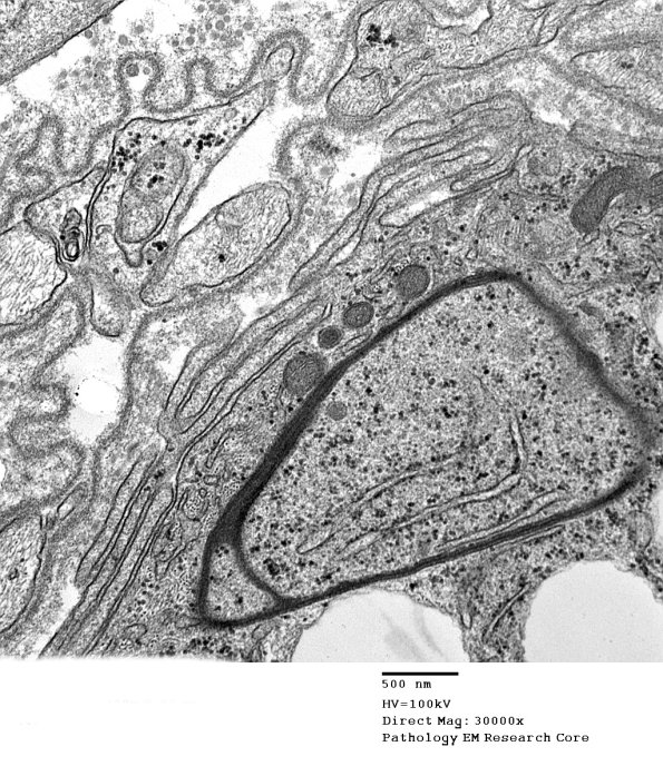 3G5 Case 4_097 - Copy