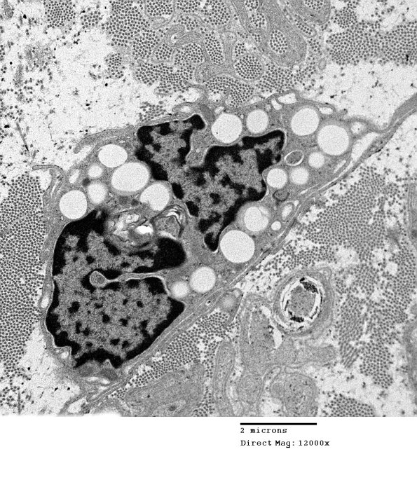 4B (Case 13 EM 023 - Copy