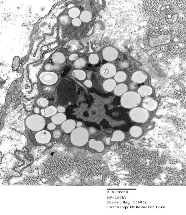 4C (Case 14) EM 008 - Copy
