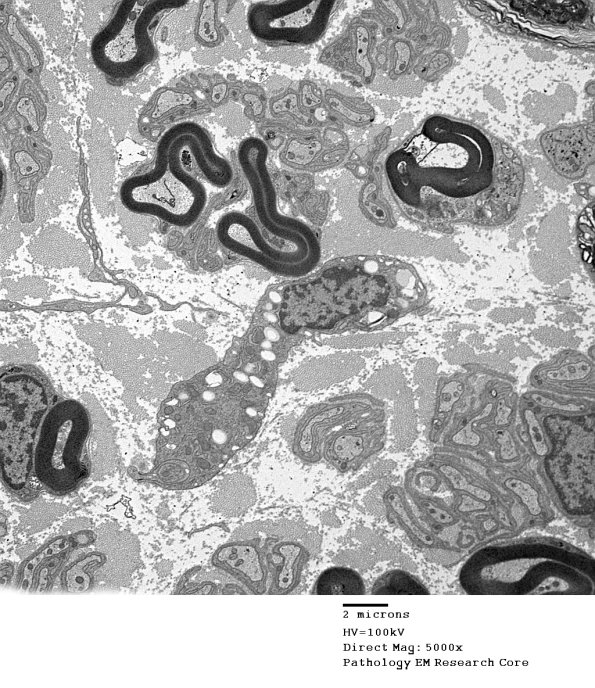 4F1 (Case 16) EM 001 - Copy