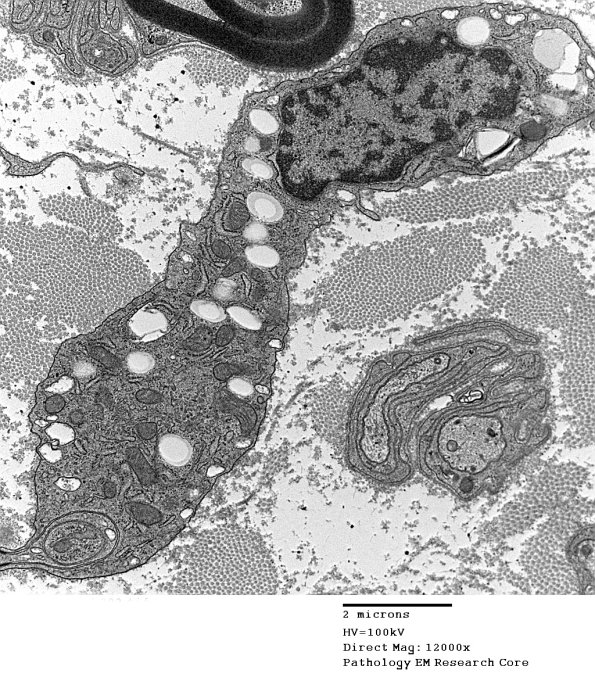 4F2 (Case 16) EM 002 - Copy