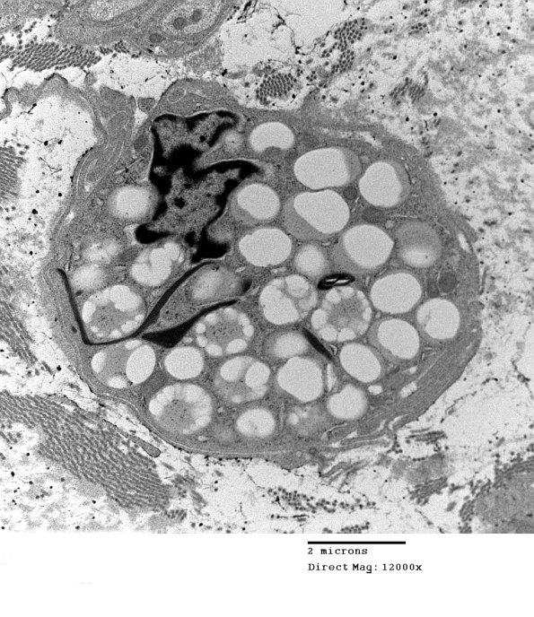 4g (Case 13) EM 015 - Copy