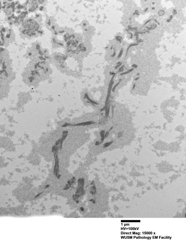 6B1 (Case 6) EM 003 - Copy