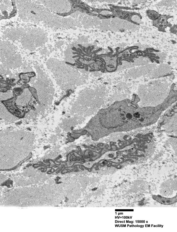 6B4 (Case 6) EM 015 - Copy
