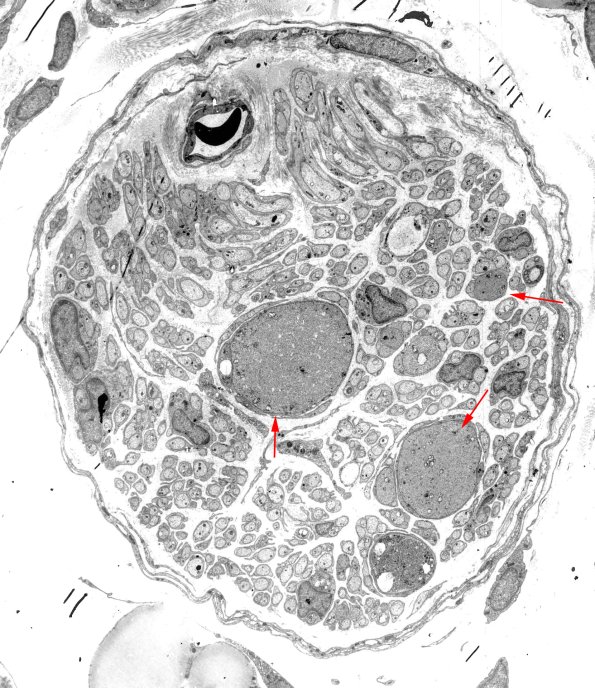 10A1 BK34-227 DM Rat Mesenteric nerve copy