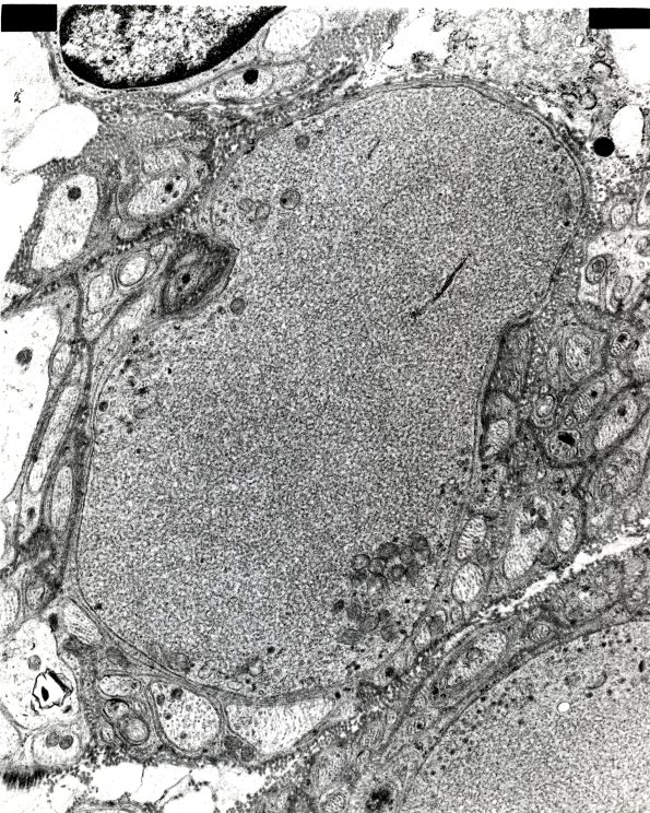 10A5 NAD Mesenteric nerve EM 2