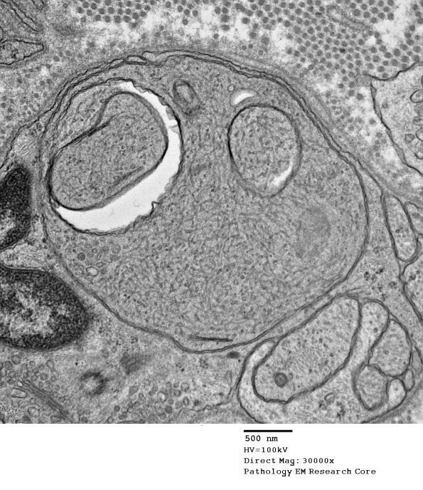 11A2 AD (Case 18) EM 086 - Copy