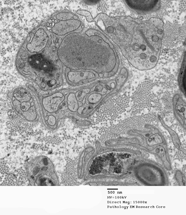 11F1 AD (Case 18) EM 128 - Copy
