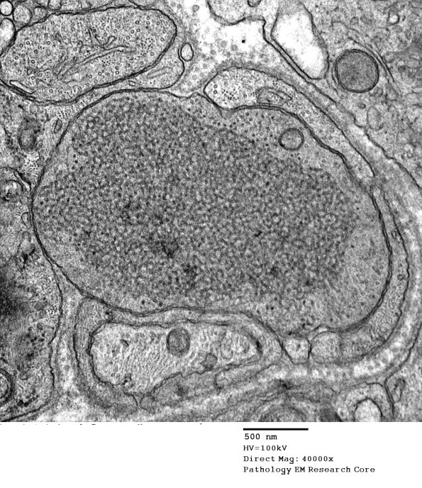 11F2 AD (Case 18) EM 130 - Copy