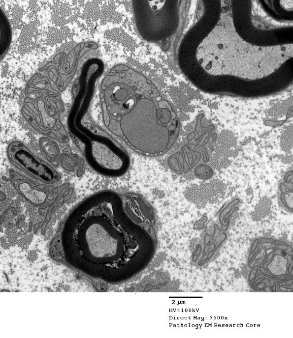 11G1 AD (Case 18) EM 142 - Copy