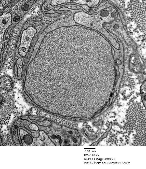 11G2 AD (Case 18) EM 0 - Copy