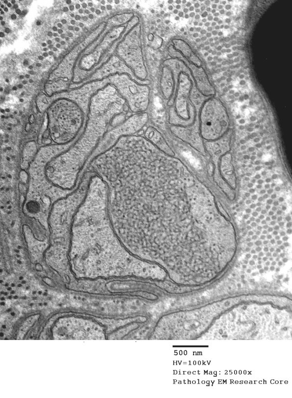 11I1 AD (Case 18) EM 5 - Copy