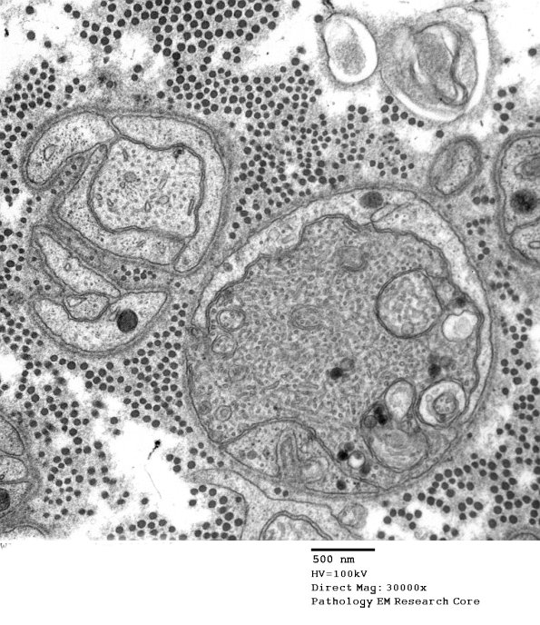 11P1 (Case 24) 2_017 - Copy