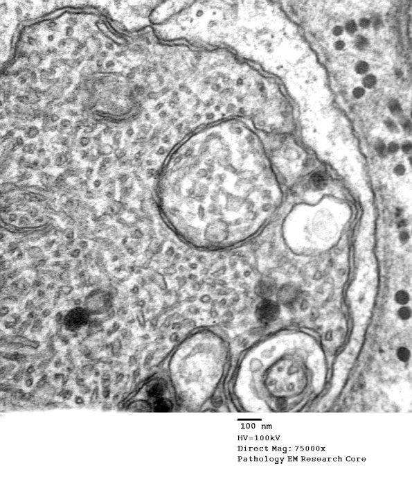 11P2 (Case 24) 2_019 - Copy