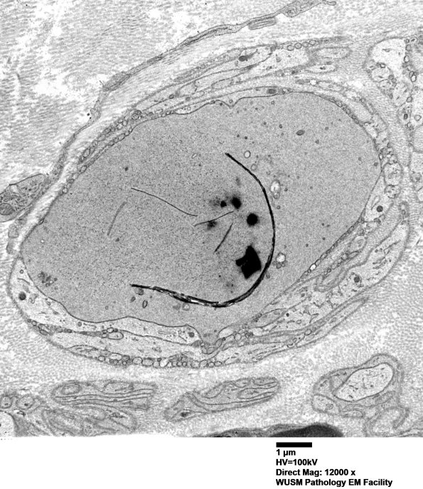 11R1 (Case 25) Sural_031 - Copy