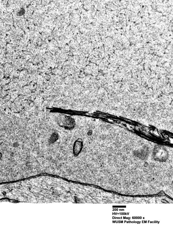 11R2 (Case 25) Sural_033 - Copy