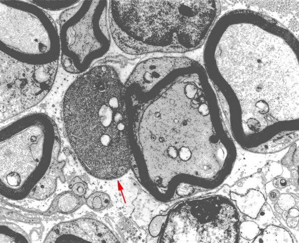 12A2 EM 40 brighter copy - Copy