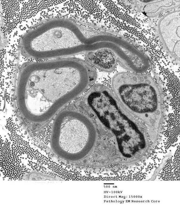 14A1 (Case 14) EM040 - Copy