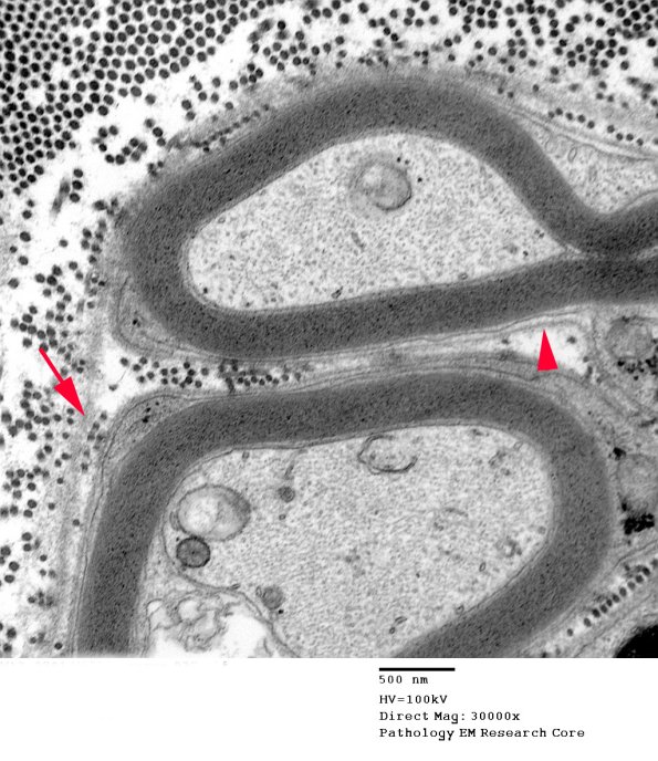14A2 (Case 14) EM037 copy - Copy