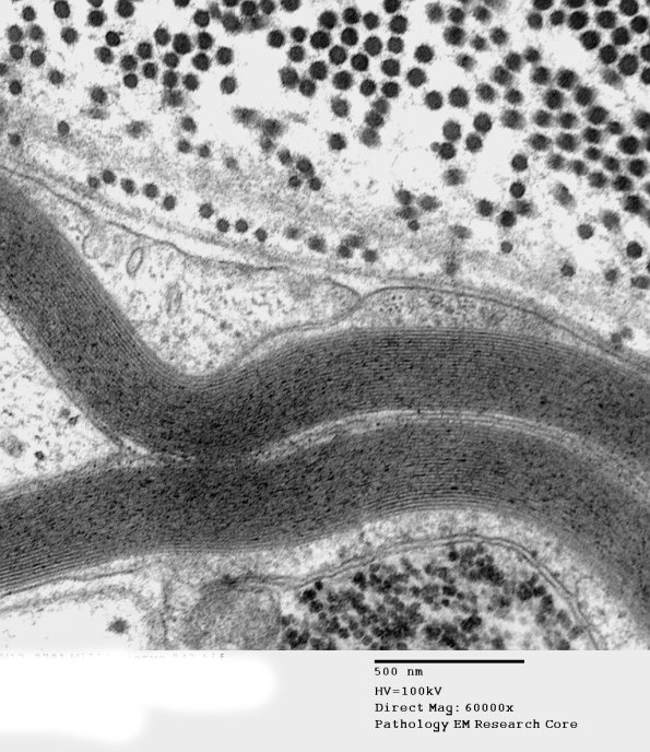 14A3 (Case 14) EM042 - Copy