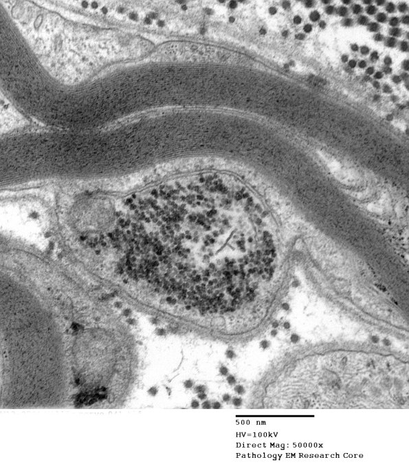 14A4 (Case 14) EM041 - Copy