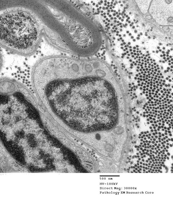 14A5 (Case 14) EM038 - Copy