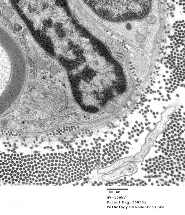 14A6 (Case 14) EM039 - Copy