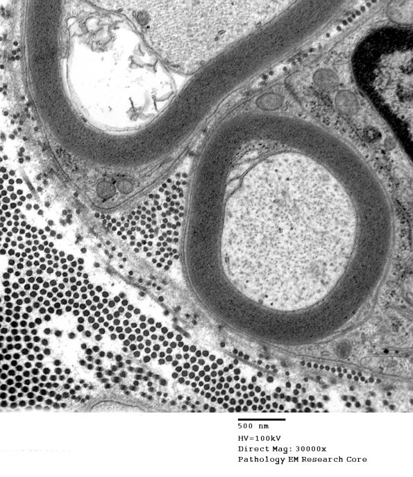 14A7 (Case 14) EM036 - Copy