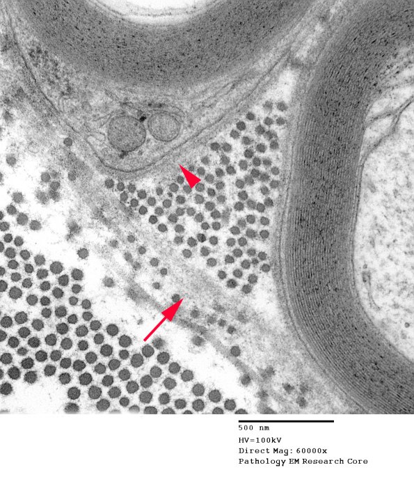 14A8 (Case 14) EM044 copy - Copy
