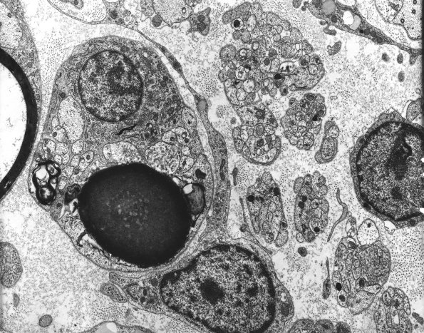 1A1 Axons, regeneration (IV-55) Rat sciatic EM 2A (2)