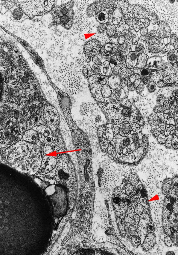 1A2 Axons, regeneration (IV-55) Rat sciatic EM 2a copy