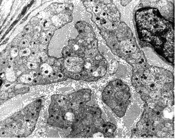 1A3 Axons, regeneration (IV-236 CR3-3) Rat sciatic EM 1