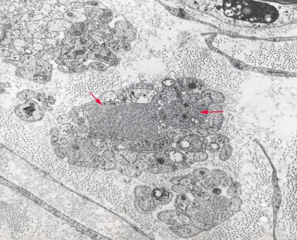 1A5 Axons, regeneration (IV-55) Rat sciatic EM 1A copy