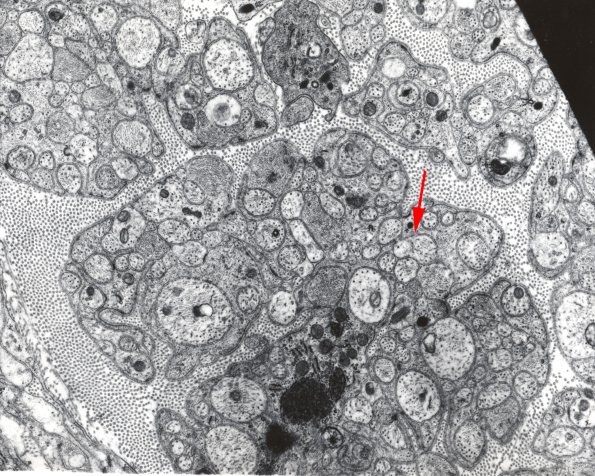 1A7 Axonal sprouts (rat mesenteric nerve) EM 1 copy