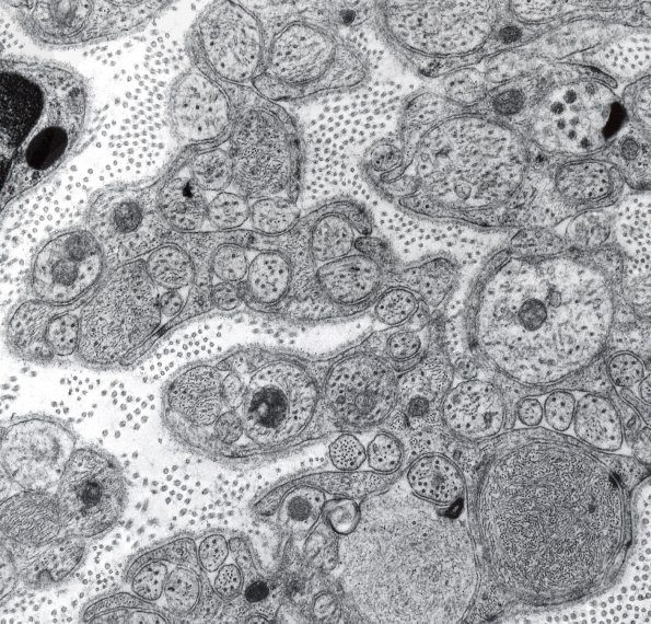 1A8 Regeneration, ileal mesenteric crushed nn (IV-47, DM7A-1 EM a