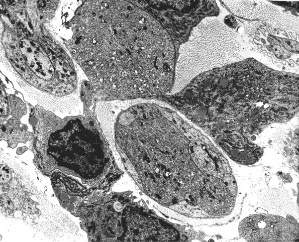 2A3 Axons, regeneration (IV-55) Rat sciatic EM 64