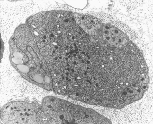 2A4 Axons, regeneration (IV-55) Rat sciatic EM 5