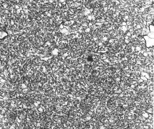 2A8 Growth cone, rat frustrated regeneration 40,000X