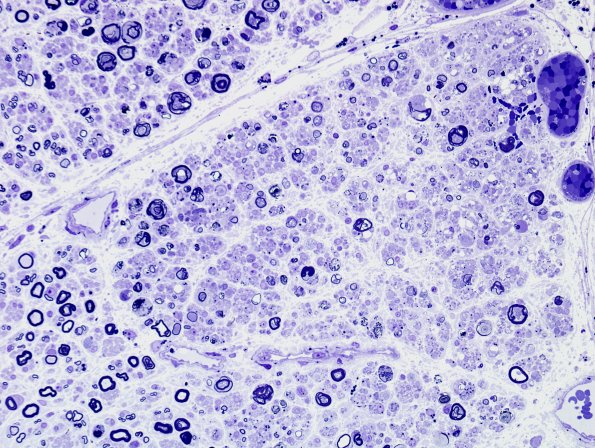 3A2 SLE (Case 1) Plastic 1.jpg