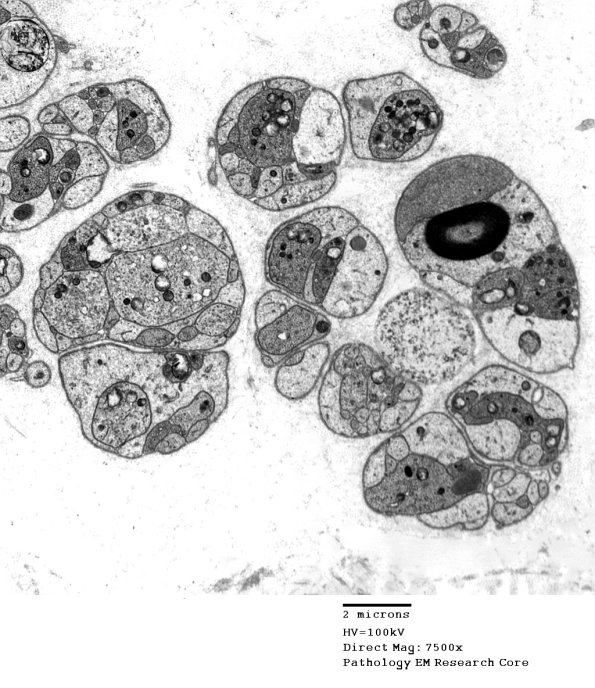 3B1 Axonal Regeneration SLE EM 005 - Copy