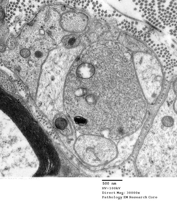 3B10A SLE (Case 1)_065 - Copy