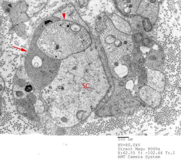 3B11A (Case 1) copy - Copy