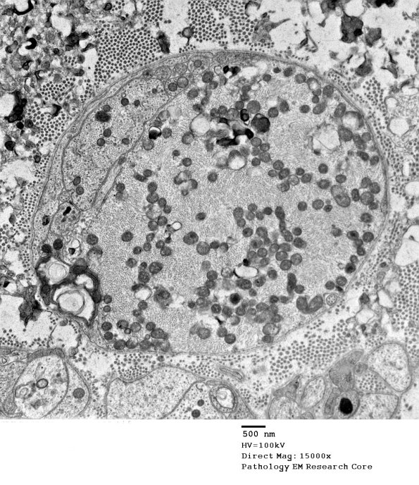 3B12 SLE (Case 1) (May 2014)_003 - Copy