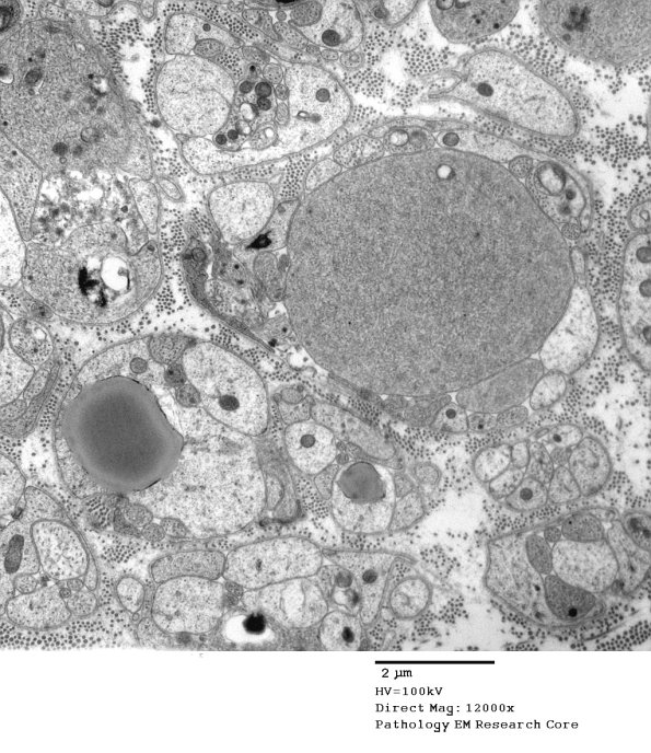 3B13A SLE Case 1 (May 2014)_046 - Copy